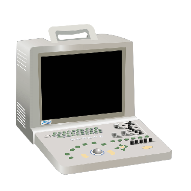 SonoScape SSI-1000